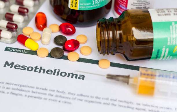 Mesothelioma Center: Comprehensive Guide to Understanding and Seeking Treatment